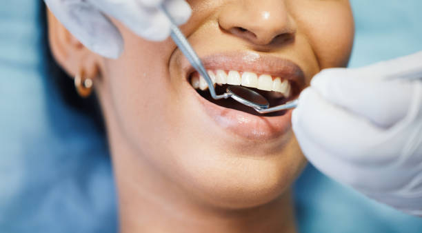 Best Knocked-Out Tooth (Avulsed Tooth) Treatment in Mackinac Island, MI