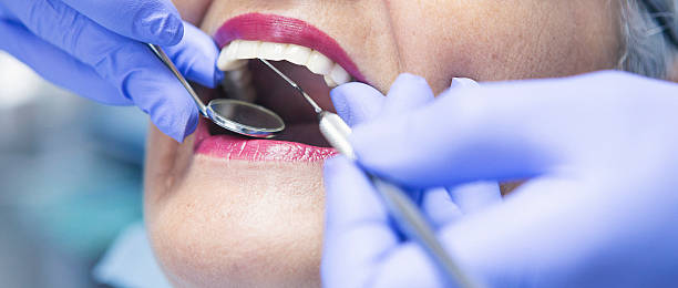 Best Dental Abscess Treatment in Mackinac Island, MI