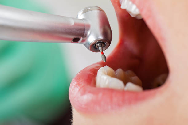 Best Emergency Treatment for Oral Infections in Mackinac Island, MI